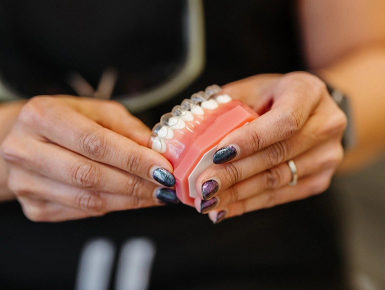 Invisalign